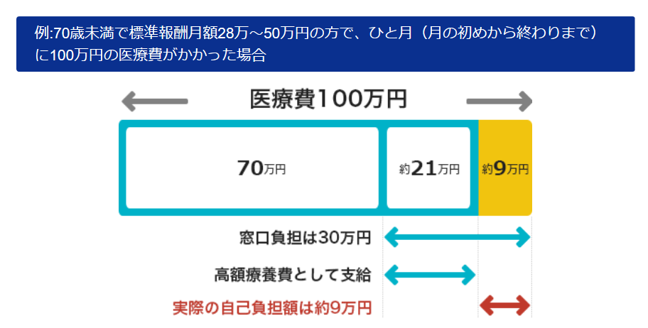 高額療養費の一例。手元に現金があれば医療保険を削減できるので、無理に頭金をつぎ込む必要はない。